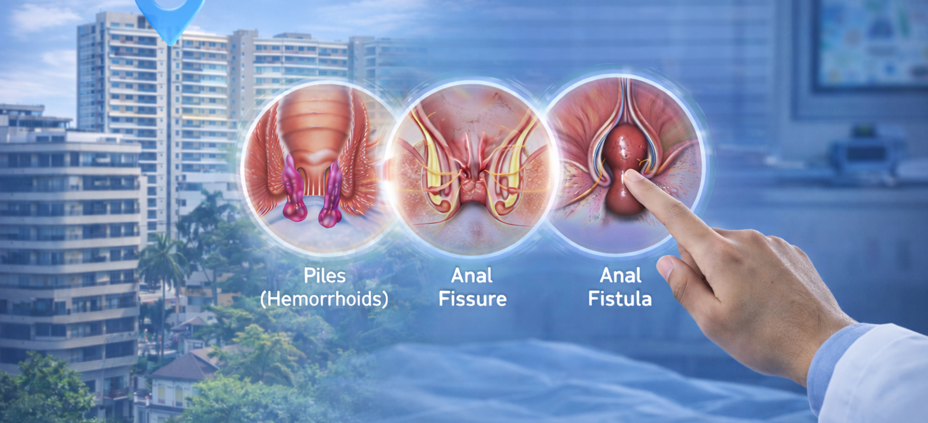 Painless Piles Treatment in Mumbai — Healing Hands Clinic